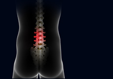 Possible Complications of Spinal Surgeries