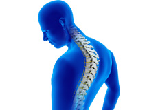 Adult Kyphosis-Types and Causes