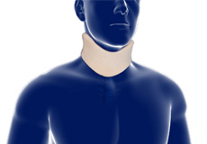 Cervical Bracing