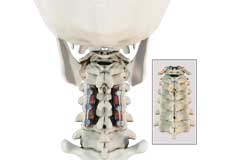 Posterior Cervical Fusion