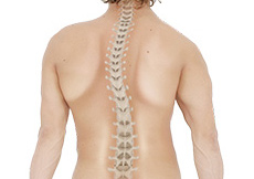 Scoliosis Surgery