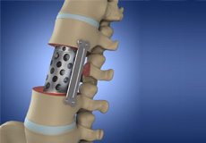 Tumor Stabilization